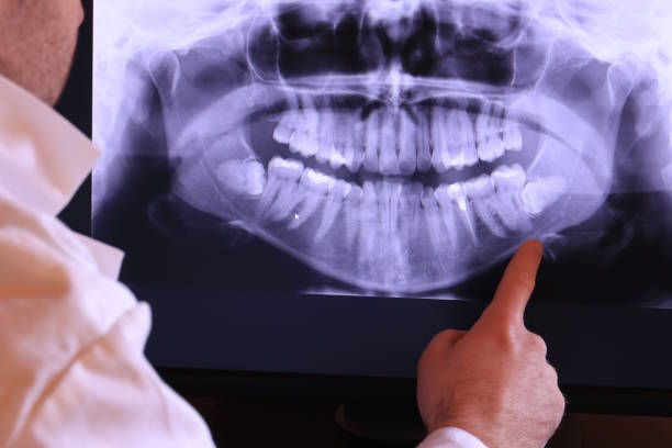 Best Dentist for Tooth Abscess  in Wright Patterson Af, OH