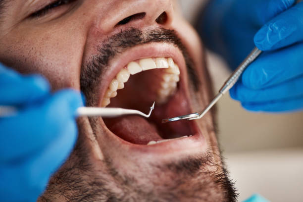 Emergency Dentist Open Today in OH