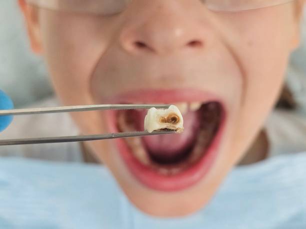 Best Tooth Pain Emergency Relief  in Wright Patterson Af, OH